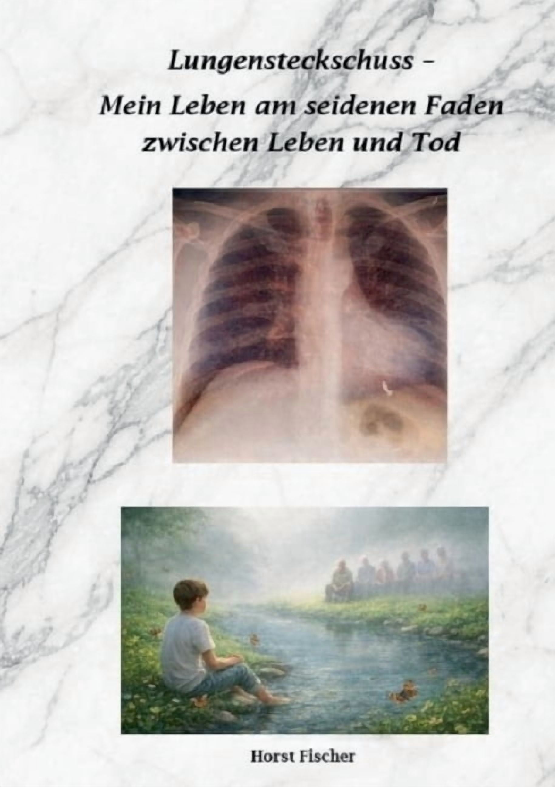 Lungensteckschuss - Mein Leben am seidenen Faden zwischen Leben und Tod: Ein persÃ¶nlicher Erfahrungsbericht Ã¼ber Leben u, (Paperback)