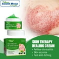 Lxiugva AntiItching Cream For Wet And Blister Skin Relieves Itching