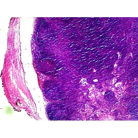 Lymph Node, Mammalian; Section by Go Science Crazy