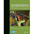 thumbnail image 1 of Lymphedema, 1 of 1
