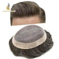 thumbnail image 1 of Lyricalhair Toupee for Men Fine Mono Mens Toupee Hairpieces Human Hair Replacement Systems Poly Coating around Man Hair Units 8"X10" #330 3# DARK BROWN WITH 30% SYNTHETIC GREY, 1 of 1