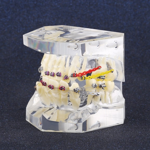 M Buder Dental Orthodontic Treatment Malocclusion Study Teeth Model with Wire Chain, 2.56 Inches / 6.5 cm