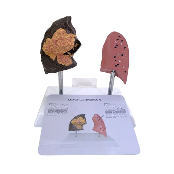 MOMOJIA Smoker And Healthy Lung PVC Anatomical Model Detailed Clinical Teaching Aid For Educators