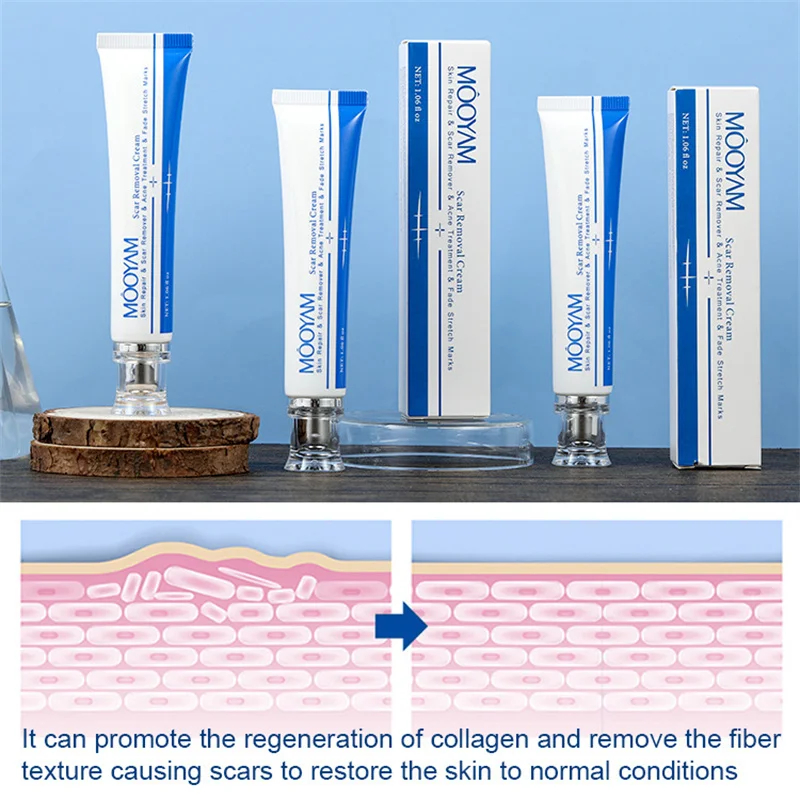 MOOYAM Scar Moisturizing Repair Treatment Surgical Scar Stretch Marks