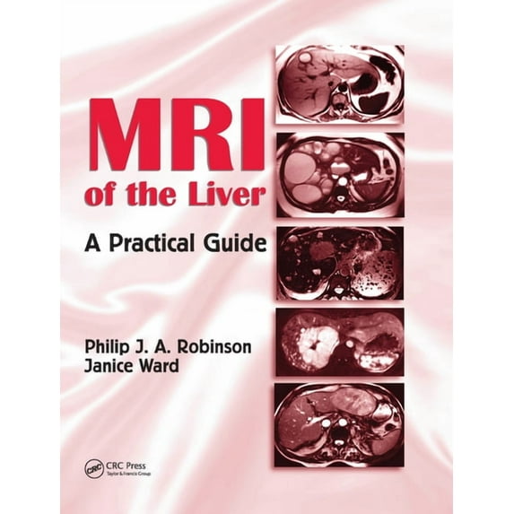MRI of the Liver: A Practical Guide, (Paperback)
