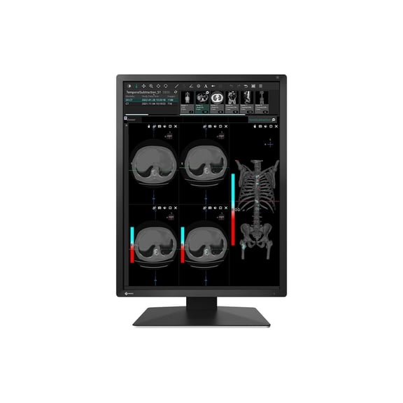 Eizo MX217-BK Mx-series21.3in Lcd Led Color Mntr Dicom Calib Blk Integ Front Sensor
