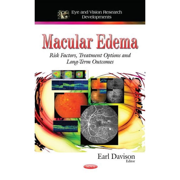 Macular Edema : Risk Factors, Treatment Options and Long-Term Outcomes