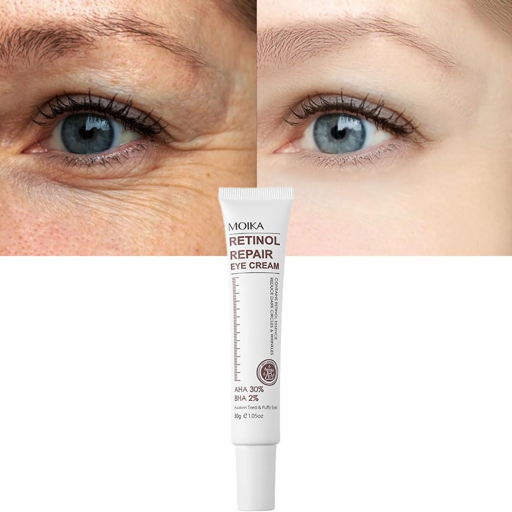 Magic Retinol Eye Cream STF9 for Dark Circles Puffiness Bags Under Eyes