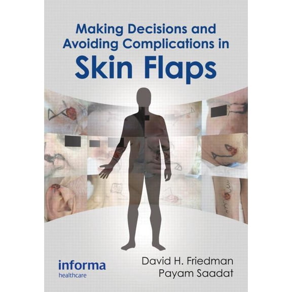 Making Decisions and Avoiding Complications in Skin Flaps, (Hardcover)