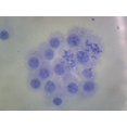 thumbnail image 1 of Male Chromosomes, Human; Smear by Go Science Crazy, 1 of 1
