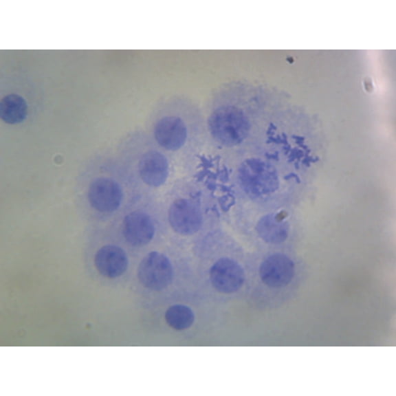 Male Chromosomes, Human; Smear by Go Science Crazy