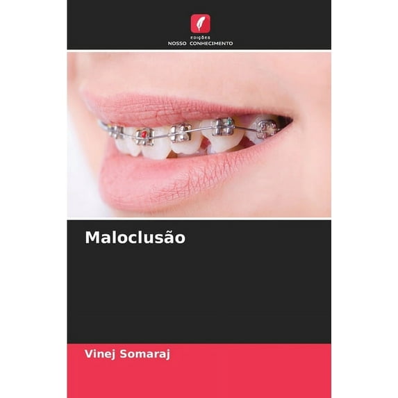 Maloclusão, (Paperback)