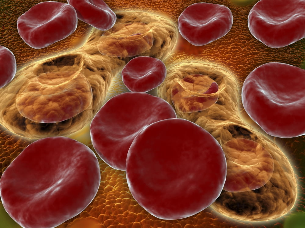 Malria spores in the human blood stream Canvas Art - Stocktrek Images (17 x 13)