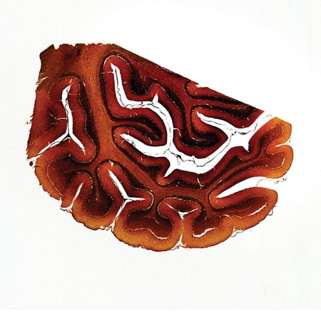 Mammal Cerebellum, Sec. 7 M Silver Stain Microscope Slide