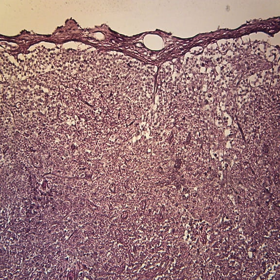 Mammal Reticular Tissue Slide, 7 M, Silver Stain