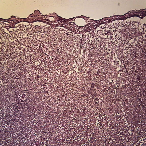 Mammal Reticular Tissue Slide, 7 M, Silver Stain