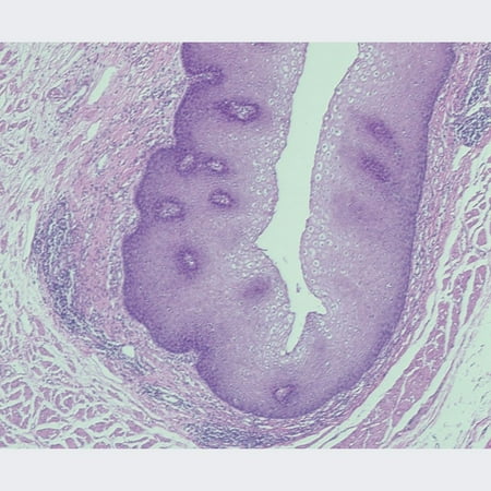 Mammal Stratified Squamous Epithelium, Sec. 7 M H&E Microscope Slide