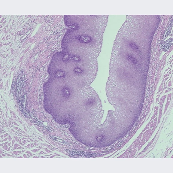 Mammal Stratified Squamous Epithelium, Sec. 7 M H&E Microscope Slide
