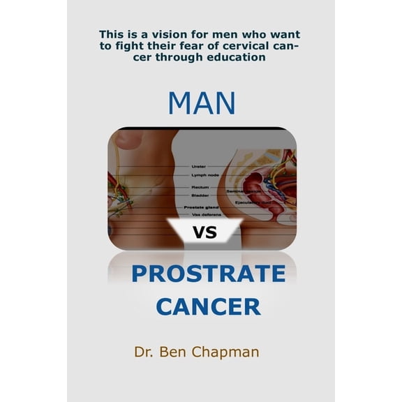 MAN Vs PROSTRATE CANCER: 100% Ageing Secret, (Paperback)