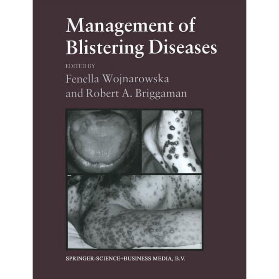 Management of Blistering Diseases, (Paperback)