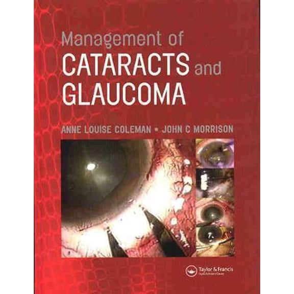 Management of Cataracts and Glaucoma (Hardcover) by Anne Louise Coleman, John C Morrison