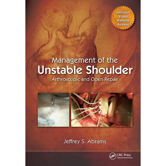 Management of the Unstable Shoulder: Arthroscopic and Open Repair, (Hardcover)