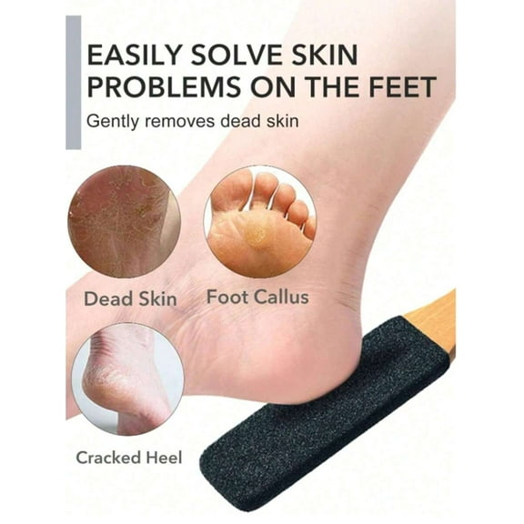 Manual Foot Scrubber & Exfoliating Tool – Callus Remover for Daily Pedicure, Smooth & Refresh Tired Feet