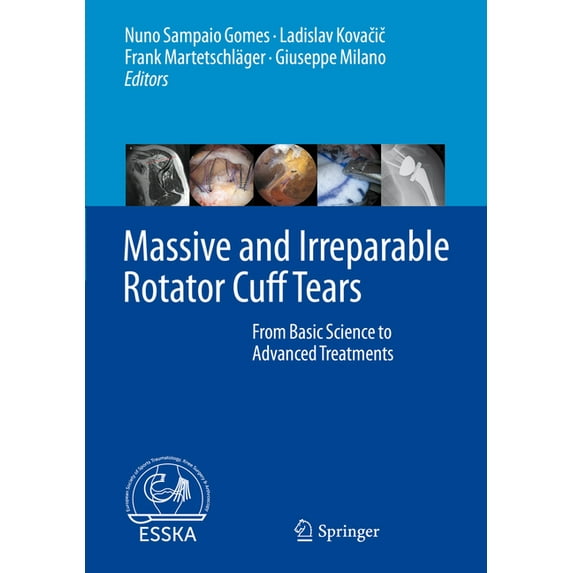 Massive and Irreparable Rotator Cuff Tears: From Basic Science to Advanced Treatments, (Hardcover)