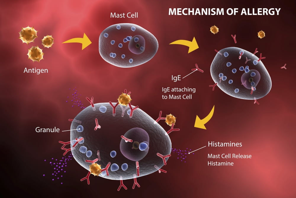 Mast cell releasing histamine due to allergic reaction Canvas Art - Stocktrek Images (18 x 12)