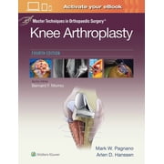 Master Techniques in Orthopaedic Surgery Master Techniques in Orthopedic Surgery Knee Arthroplasty, Hardcover