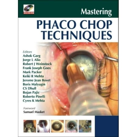 Mastering Phaco Chop Techniques (Other)