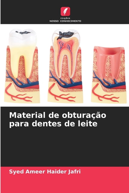 Material de obturaÃ§Ã£o para dentes de leite, (Paperback)