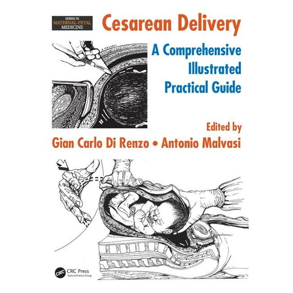 Maternal-Fetal Medicine: Cesarean Delivery: A Comprehensive Illustrated Practical Guide (Hardcover)