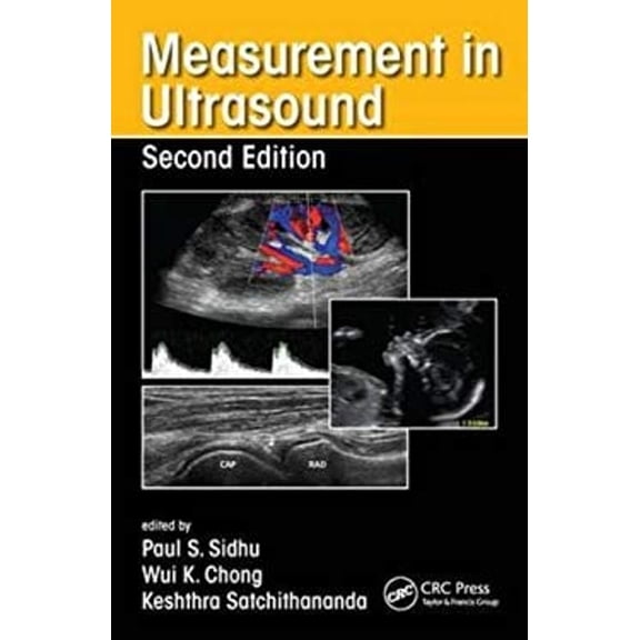 Pre-Owned Measurement in Ultrasound (Paperback) 9781482231359