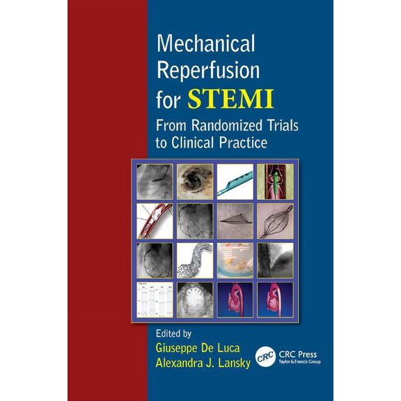 Mechanical Reperfusion for STEMI: From Randomized Trials to Clinical Practice, (Paperback)