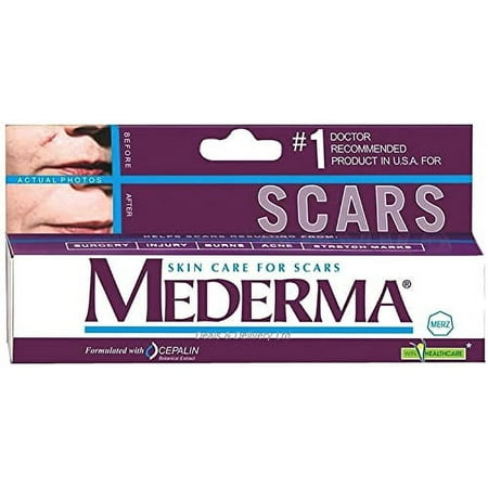 Mederma Skin Care (Helps Scars -Surgery, Injury, Burns, Acne,Stretch marks)