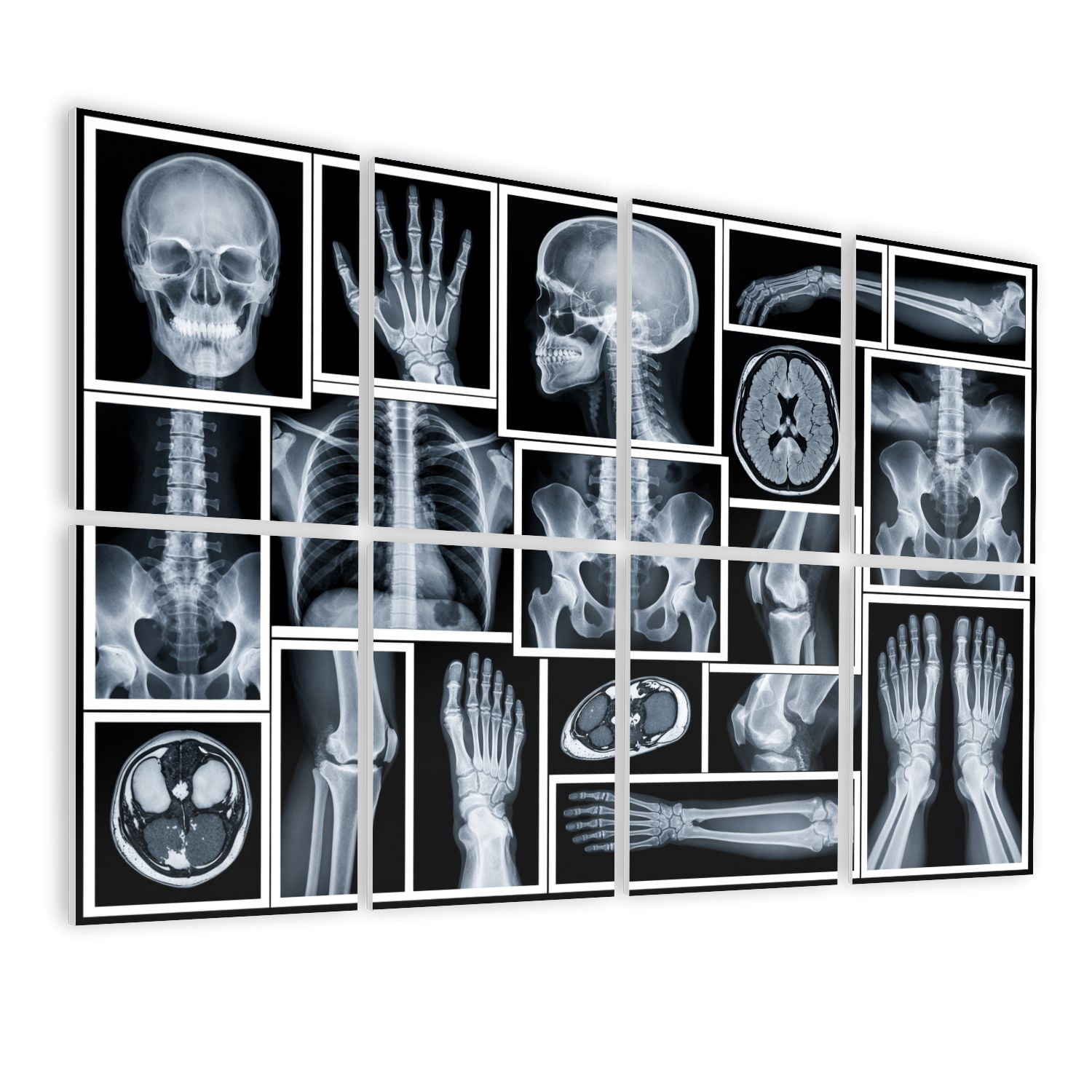 Medical 8 Pack Art Acoustic Panels Sound Absorbing Collection Human X Ray Anatomy Showing Skull Hands Spine Chest Black Decorative Soundproof Wall Panels Self Adhesive for Classroom Hospital 48"x32"