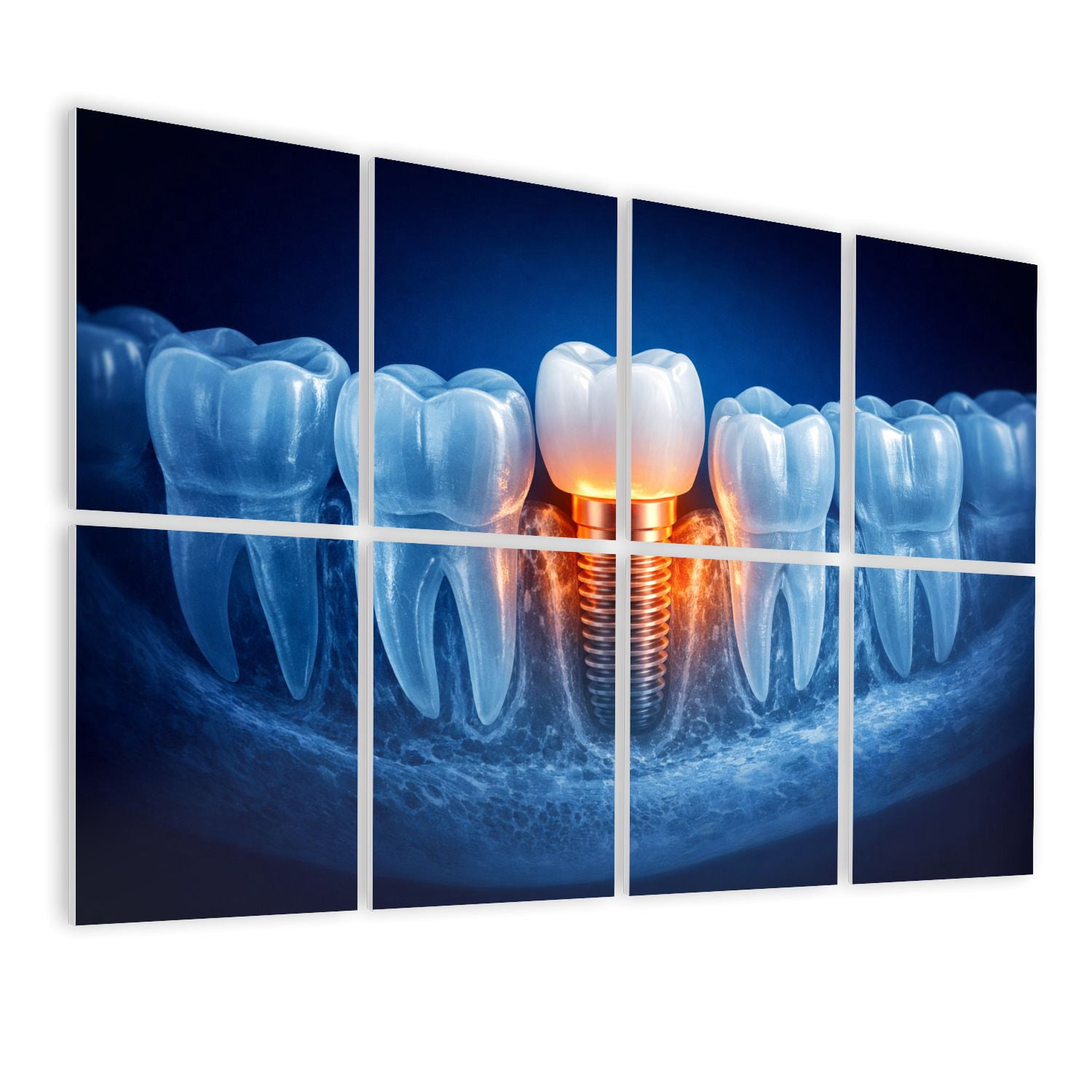 Medical 8 Pack Art Acoustic Panels Sound Absorbing Dental Implant Tooth Surgical Decorative Soundproof Wall Panels Self Adhesive for Classroom Hospital 48"x32"