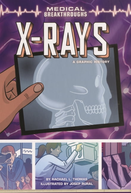 Medical Breakthroughs X-Rays: A Graphic History, (Hardcover)