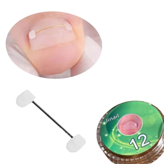 Medical Grade Adjustable Ingrown Toenail Corrector Kit Stainless Steel Home Care Tool