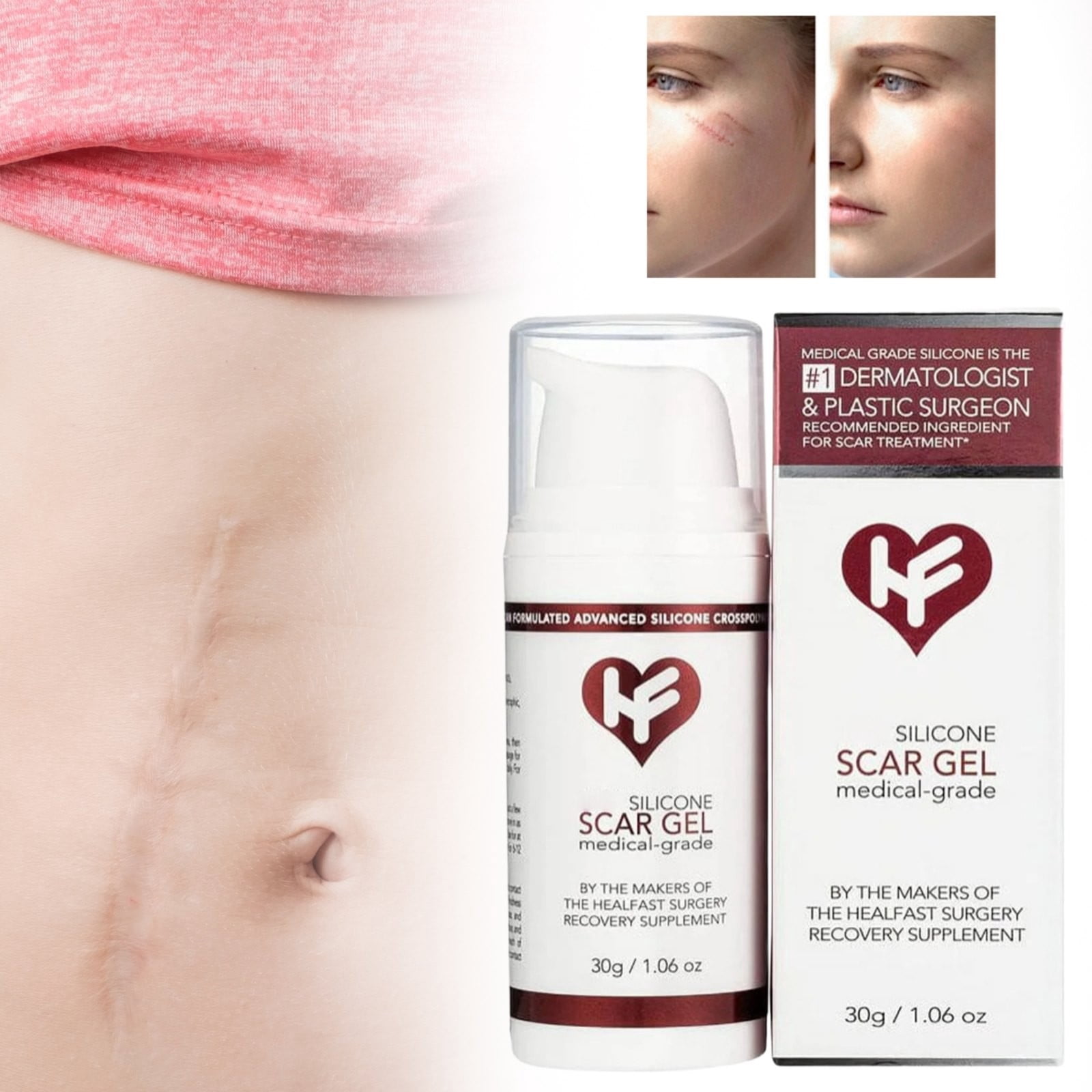 Medical Grade Silicone Scar Gel,Scar Cream,Silicone Scar Gel Semi-Solid ...