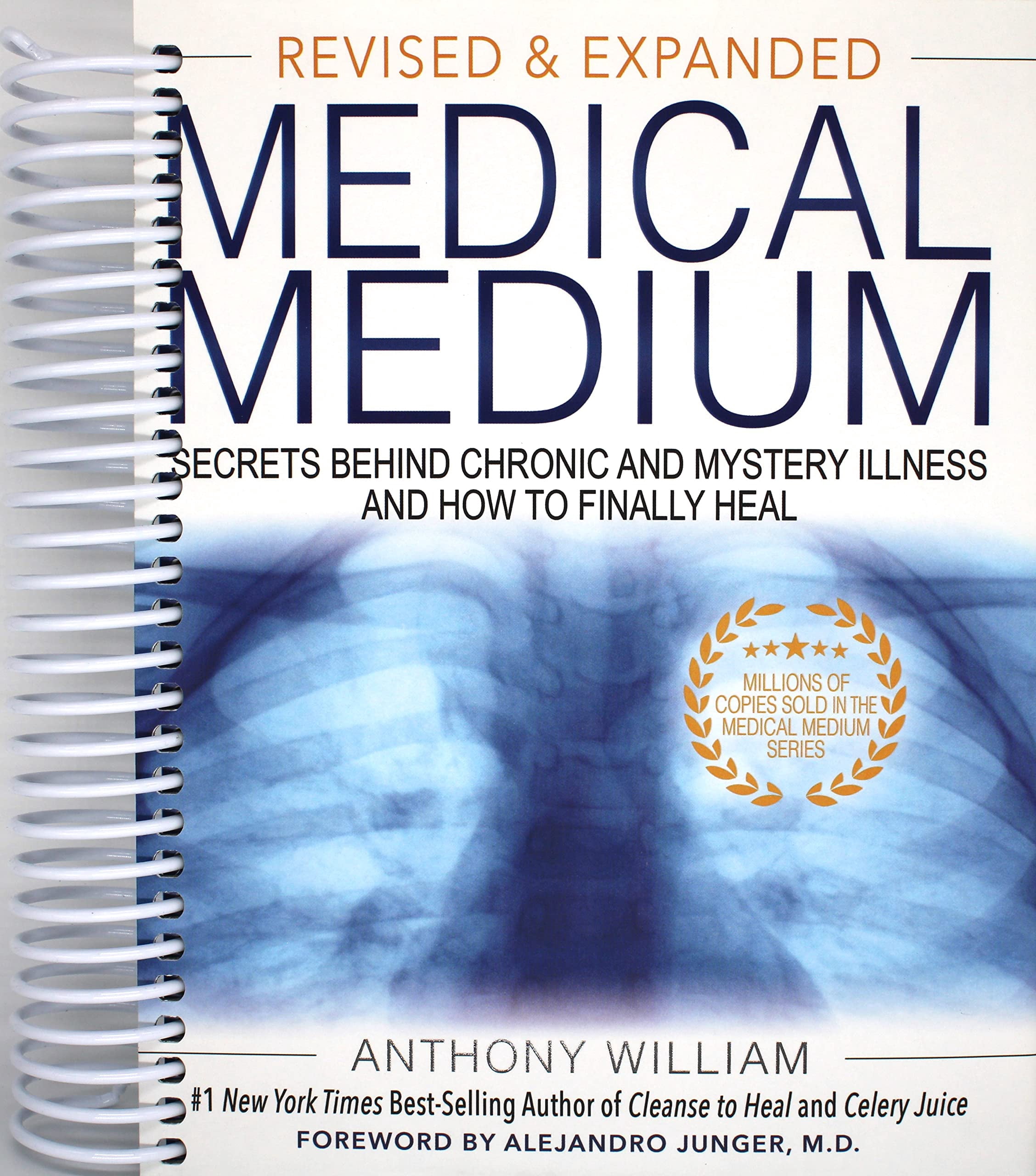 Anthony William