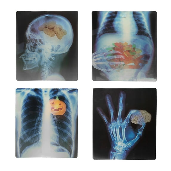 Medical Xray Images Set of 4 Funny Halloween Window Decor Human Skeleton Decal