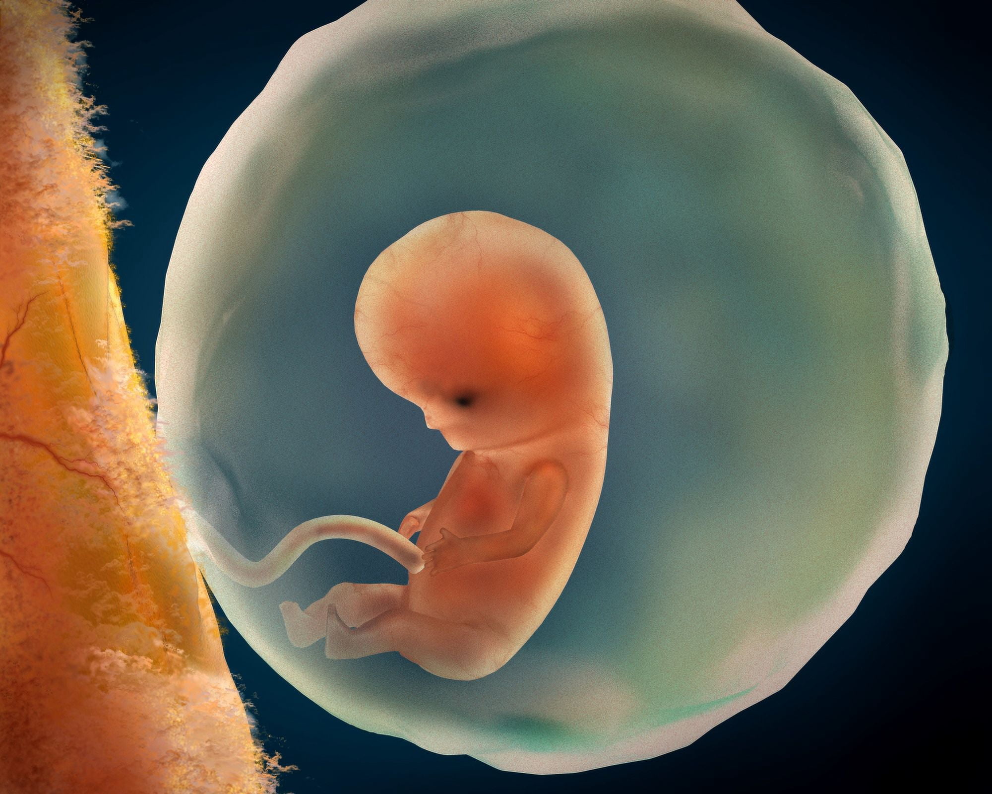 Medical illustration of fetus development at 9 weeks Canvas Art - Stocktrek Images (16 x 13)