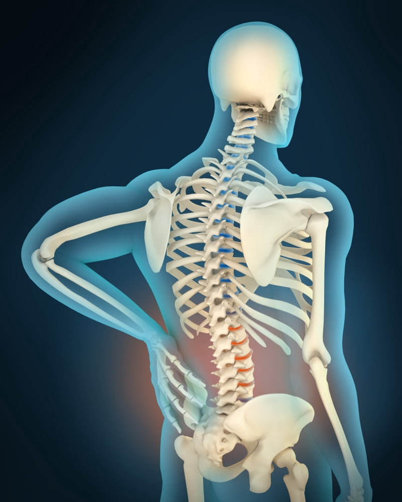 Medical illustration showing inflammation in human back area Canvas Art - Stocktrek Images (13 x 16)