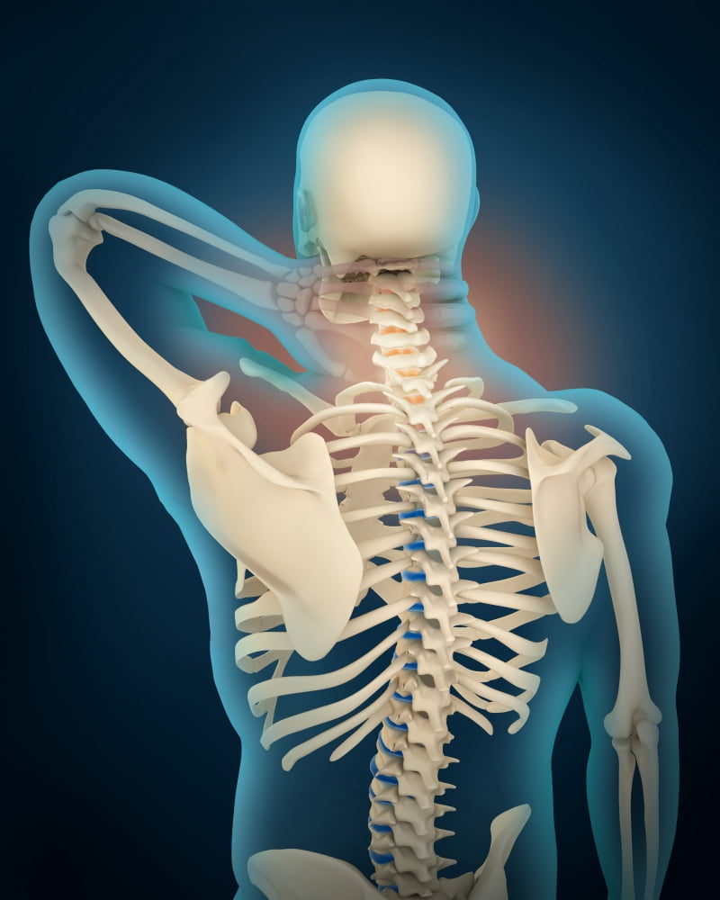 Medical illustration showing inflammation in human neck area Canvas Art - Stocktrek Images (26 x 32)