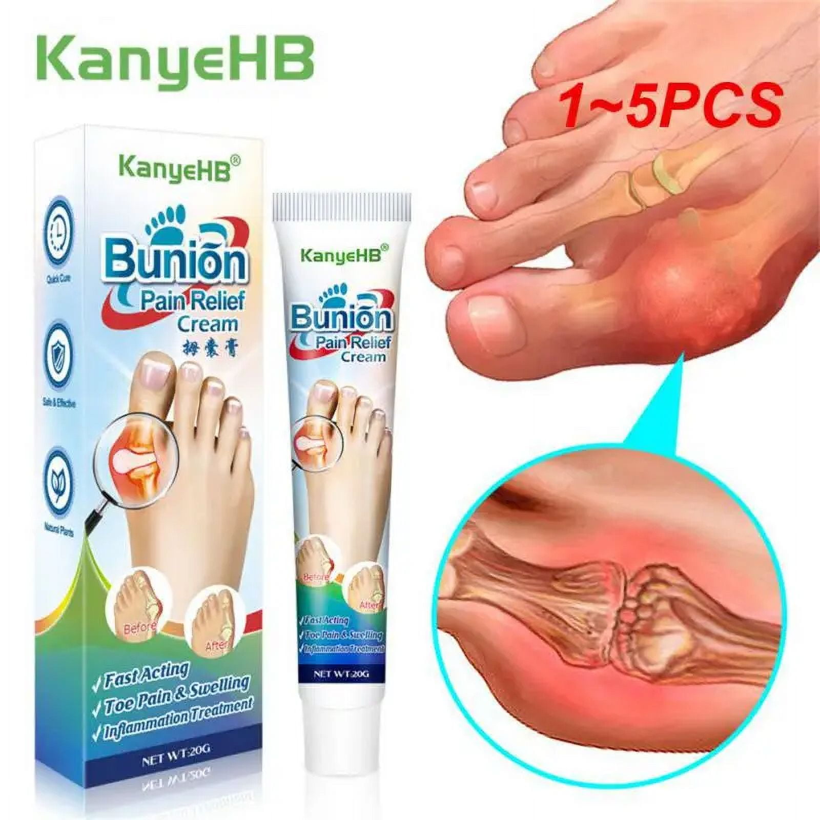 Medicine Ointment Bunion Inflammation Therapy Suitable For Treat Toe