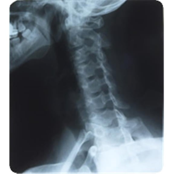 Medlink Imaging MLI1381012 RADIOMAT Medical X-Ray Film 10 Inch x 12 Inch 100 per box