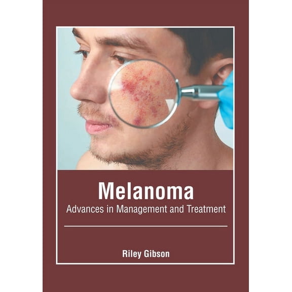 Melanoma: Advances in Management and Treatment, (Hardcover)