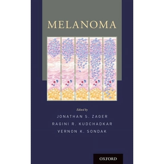 Melanoma, (Paperback)